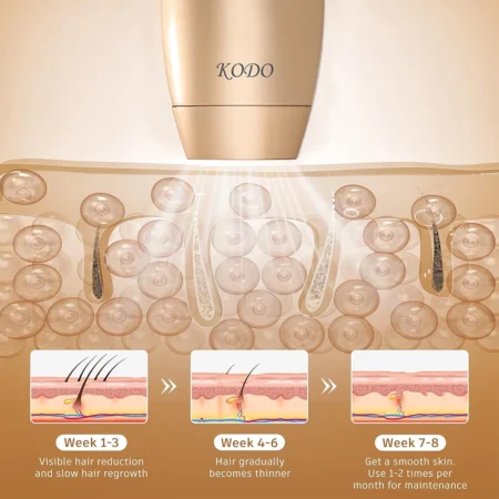 KODO 2025 IPL Laser Hair Removal – 4-in-1 Painless Epilator for Face & Body - Image 6