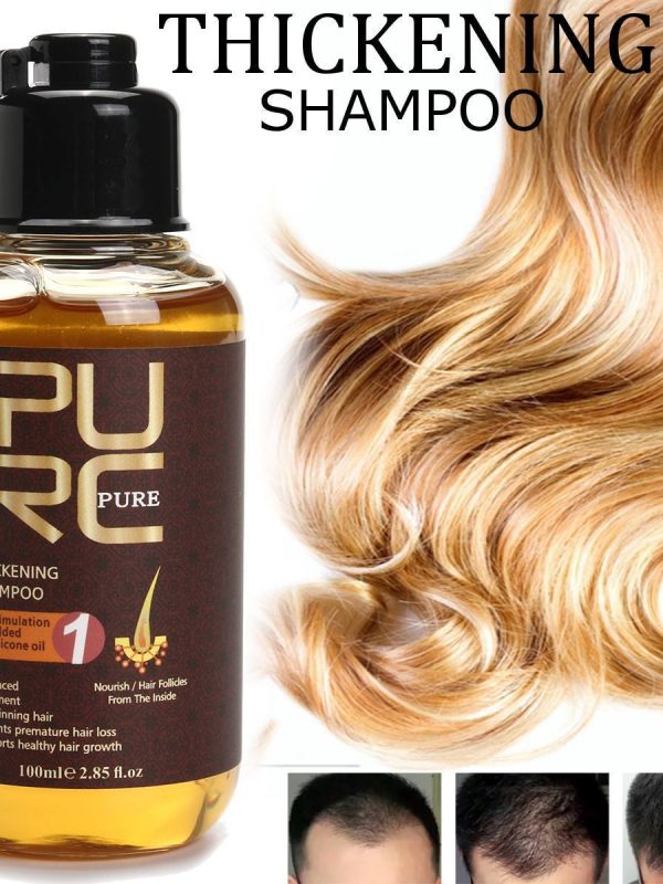Ginger Shampoo Reduces Hair Loss And Strengthens Hair